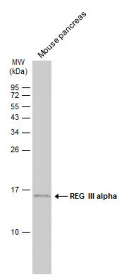 Invitrogen REG3A Polyclonal Antibody 100 &mu;L; Unconjugated:Antibodies,