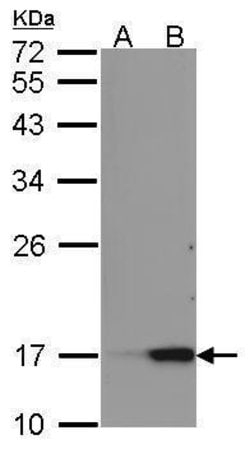 Invitrogen REG3A Polyclonal Antibody 100 &mu;L; Unconjugated:Antibodies,