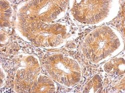 Invitrogen alpha TTP Polyclonal Antibody 100 &mu;L; Unconjugated:Antibodies,
