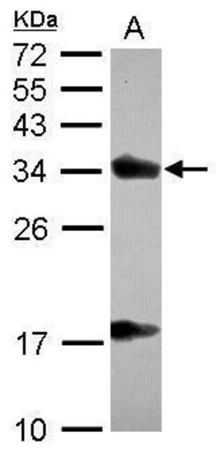 Invitrogen alpha TTP Polyclonal Antibody 100 &mu;L; Unconjugated:Antibodies,
