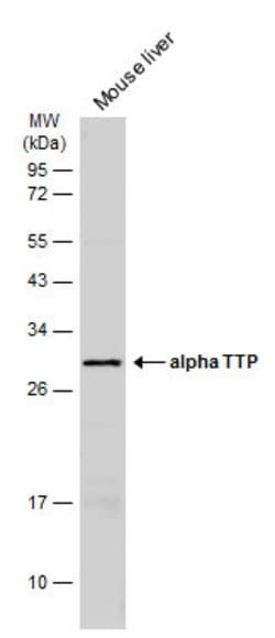 Invitrogen alpha TTP Polyclonal Antibody 100 &mu;L; Unconjugated:Antibodies,
