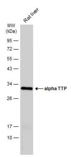 Invitrogen alpha TTP Polyclonal Antibody 100 &mu;L; Unconjugated:Antibodies,