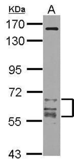 Invitrogen CaMKII gamma Polyclonal Antibody 100 &mu;L; Unconjugated:Antibodies,