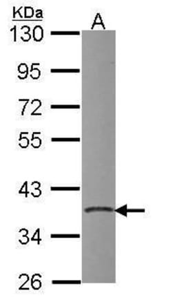 Invitrogen PDIK1L Polyclonal Antibody 100 &mu;L | Buy Online | Invitrogen&trade; | Fisher Scientific