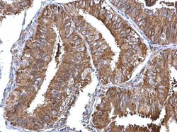 Invitrogen NME1 Polyclonal Antibody 100 &mu;L; Unconjugated:Antibodies,