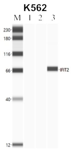 Invitrogen IFIT2 Polyclonal Antibody 100 &mu;L; Unconjugated:Antibodies,