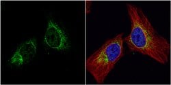 Invitrogen IFIT2 Polyclonal Antibody 100 &mu;L; Unconjugated:Antibodies,