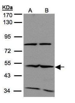 Invitrogen IFIT2 Polyclonal Antibody 100 &mu;L; Unconjugated:Antibodies,