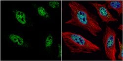 Invitrogen HES1 Polyclonal Antibody 100 &mu;L; Unconjugated:Antibodies,