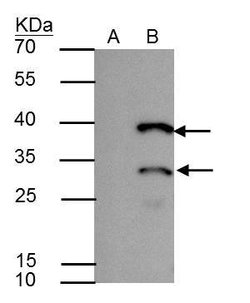 Invitrogen HES1 Polyclonal Antibody 100 &mu;L; Unconjugated:Antibodies,
