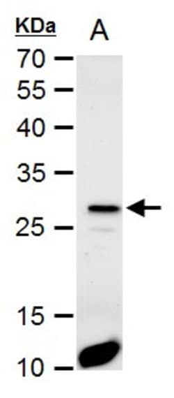 Invitrogen HES1 Polyclonal Antibody 100 &mu;L; Unconjugated:Antibodies,