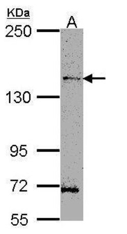 Invitrogen HIPK3 Polyclonal Antibody 100 &mu;L; Unconjugated:Antibodies,