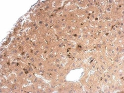 Invitrogen Syntenin 1 Polyclonal Antibody 100 &mu;L; Unconjugated:Antibodies,