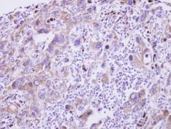 Invitrogen GDF5 Polyclonal Antibody 100 &mu;L; Unconjugated:Antibodies,