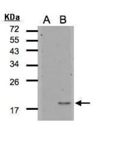 Invitrogen IL1F5 Polyclonal Antibody 100 &mu;L | Buy Online | Invitrogen&trade; | Fisher Scientific