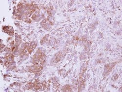Invitrogen CCL14 Polyclonal Antibody 100 &mu;L | Buy Online | Invitrogen&trade; | Fisher Scientific