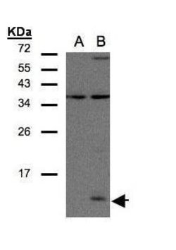 Invitrogen CCL14 Polyclonal Antibody 100 &mu;L | Buy Online | Invitrogen&trade; | Fisher Scientific