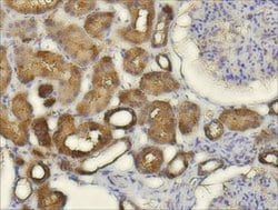 Invitrogen CXCL14 Polyclonal Antibody 100 &mu;L; Unconjugated:Antibodies,