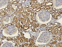Invitrogen CXCL14 Polyclonal Antibody 100 &mu;L; Unconjugated:Antibodies,