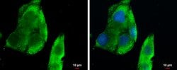 Invitrogen CXCL13 Polyclonal Antibody 100 &mu;L; Unconjugated:Antibodies,