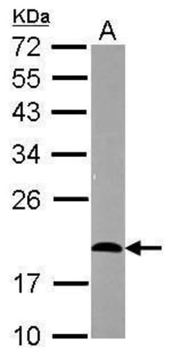 Invitrogen CD3e Polyclonal Antibody 100 &mu;L | Buy Online | Invitrogen&trade; | Fisher Scientific