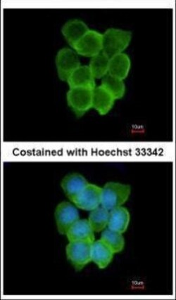 Invitrogen CHRND Polyclonal Antibody 100 &mu;L; Unconjugated:Antibodies,