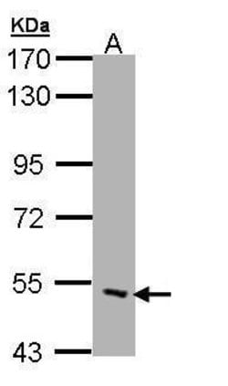 Invitrogen CHRND Polyclonal Antibody 100 &mu;L; Unconjugated:Antibodies,