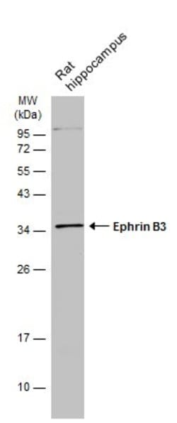 Invitrogen Ephrin B3 Polyclonal Antibody 100 &mu;L; Unconjugated:Antibodies,