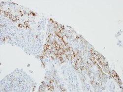 Invitrogen FCER1G Polyclonal Antibody 100 &mu;L; Unconjugated:Antibodies,