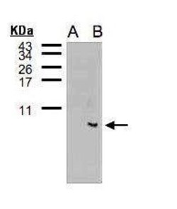 Invitrogen FCER1G Polyclonal Antibody 100 &mu;L; Unconjugated:Antibodies,