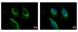 Invitrogen CD122 Polyclonal Antibody 100 &mu;L; Unconjugated:Antibodies,