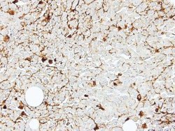 Invitrogen CD122 Polyclonal Antibody 100 &mu;L; Unconjugated:Antibodies,