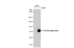 Invitrogen CD122 Polyclonal Antibody 100 &mu;L; Unconjugated:Antibodies,