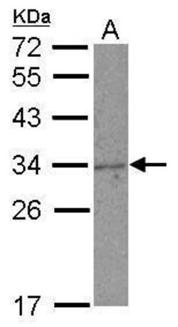 NKG2A Polyclonal Antibody, Invitrogen 100 μL; Unconjugated:Antibodies,