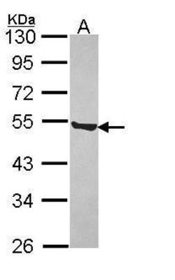 P2X5 Polyclonal Antibody, Invitrogen 100 μL; Unconjugated:Antibodies,