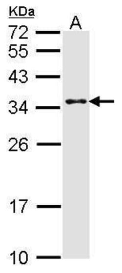Invitrogen CRSP9 Polyclonal Antibody 100 &mu;L | Buy Online | Invitrogen&trade; | Fisher Scientific