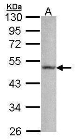 Invitrogen Fibulin 5 Polyclonal Antibody 100 &mu;L | Buy Online | Invitrogen&trade; | Fisher Scientific