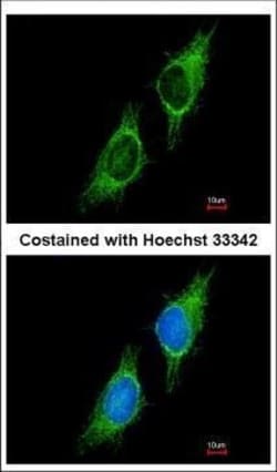 Invitrogen P2X2 Polyclonal Antibody 100 &mu;L; Unconjugated:Antibodies,