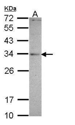 Invitrogen MED4 Polyclonal Antibody 100 &mu;L; Unconjugated:Antibodies,