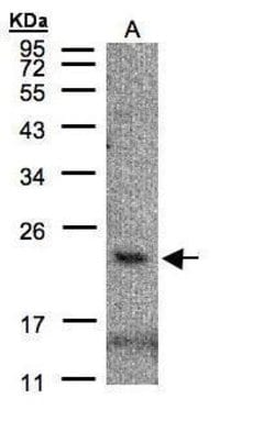 Invitrogen CMTM3 Polyclonal Antibody 100 &mu;L | Buy Online | Invitrogen&trade; | Fisher Scientific