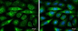 Invitrogen BMP-8A Polyclonal Antibody 100 &mu;L; Unconjugated:Antibodies,