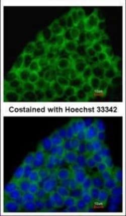 Invitrogen BMP-8A Polyclonal Antibody 100 &mu;L; Unconjugated:Antibodies,