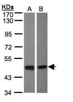Invitrogen BMP-8A Polyclonal Antibody 100 &mu;L; Unconjugated:Antibodies,