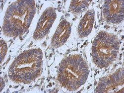 Invitrogen Axl Polyclonal Antibody 100 &mu;L; Unconjugated:Antibodies,