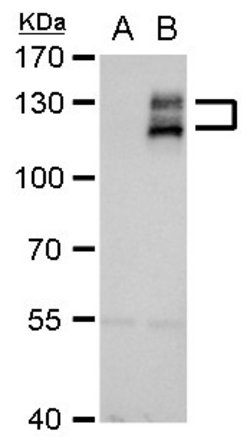 Invitrogen Axl Polyclonal Antibody 100 &mu;L; Unconjugated:Antibodies,