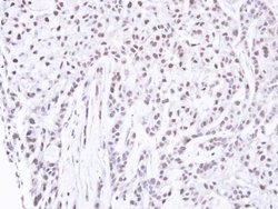 PNK Polyclonal Antibody, Invitrogen 100 &mu;L; Unconjugated:Antibodies,