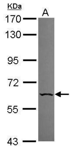 PNK Polyclonal Antibody, Invitrogen 100 &mu;L; Unconjugated:Antibodies,