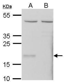 Invitrogen GPX7 Polyclonal Antibody 100 &mu;L | Buy Online | Invitrogen&trade; | Fisher Scientific