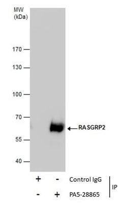 Invitrogen RASGRP2 Polyclonal Antibody 100 &mu;L; Unconjugated:Antibodies,