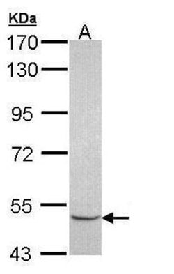 Invitrogen MINPP1 Polyclonal Antibody 100 &mu;L; Unconjugated:Antibodies,